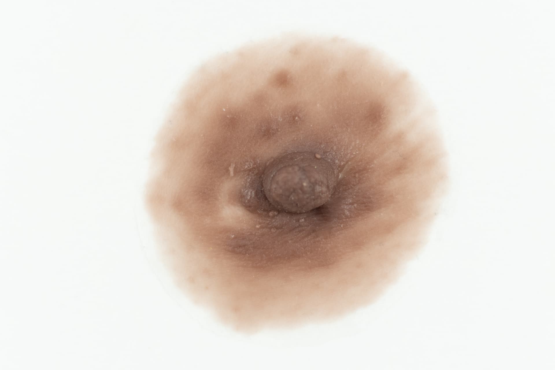 Simulador Epitelial Externo Macro